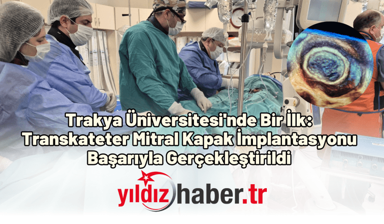 Trakya Üniversitesi’nde Bir İlk: Transkateter Mitral Kapak İmplantasyonu Başarıyla Gerçekleştirildi